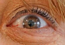 Minorías con cirugía de retina con peor resultado que blancos