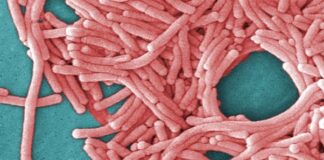 La legionelosis es un tipo de neumonía causada por la bacteria Legionella, que crece en agua tibia. Foto: Archivo
